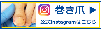 東住吉区のよしだクリニックの巻き爪インスタグラム