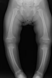 院長コラム こどもとかぞくの整形外科よしだクリニック