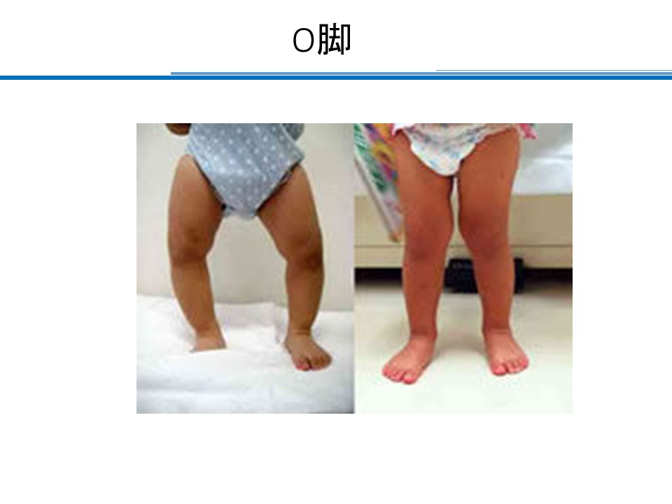 院長コラム｜こどもとかぞくの整形外科よしだクリニック
