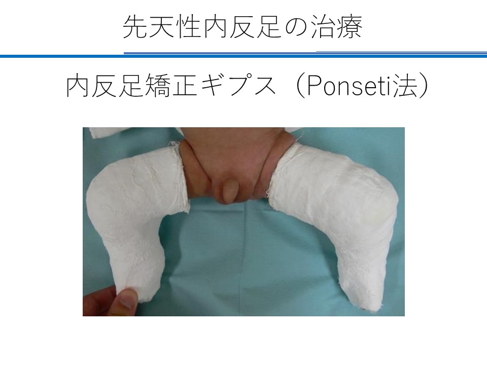 院長コラム こどもとかぞくの整形外科よしだクリニック 院長コラム こどもとかぞくの整形外科よしだクリニック