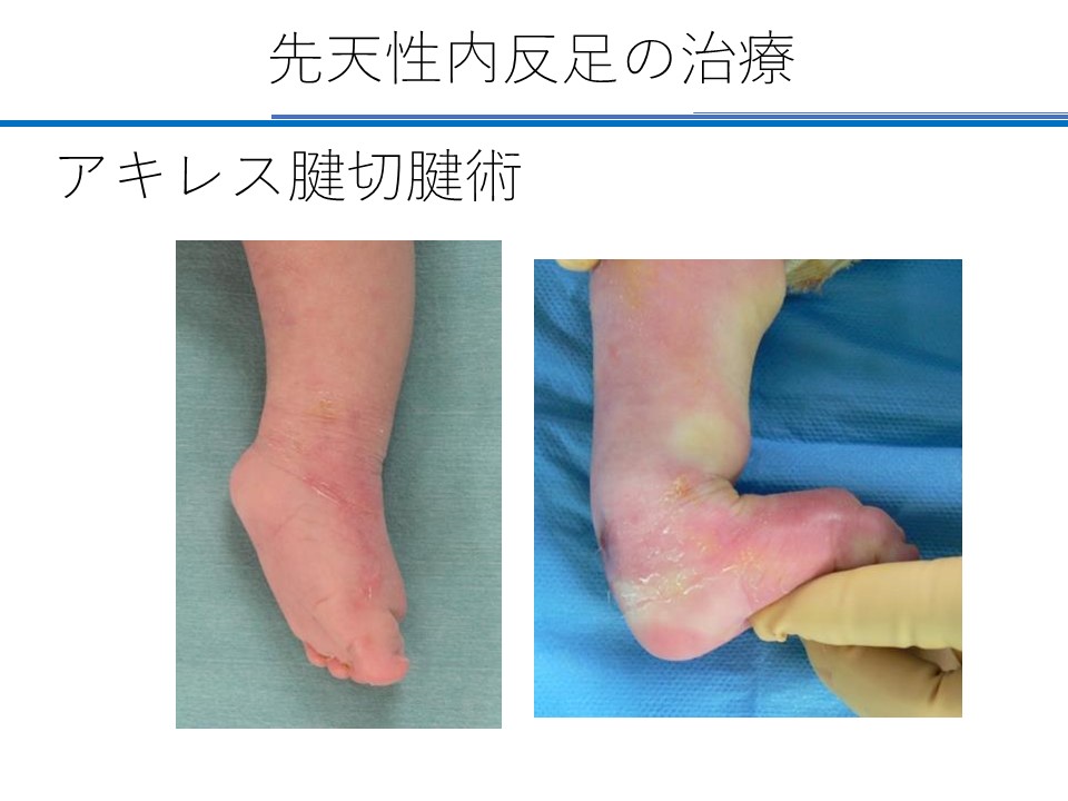 院長コラム こどもとかぞくの整形外科よしだクリニック 院長コラム こどもとかぞくの整形外科よしだクリニック