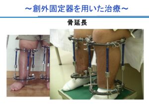 院長コラム|こどもとかぞくの整形外科よしだクリニック